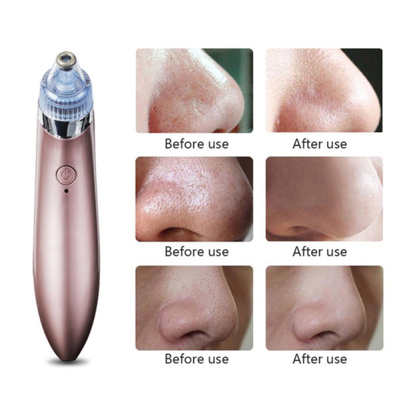 Вакуумний апарат для чищення пор Beauty Skin Care Specialist XN-8030 - Практичний вибір за бюджетною вартістю