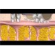 Антицелюлітний масажер Benice Body Slimmer BS45 - Вигідне рішення для кожного